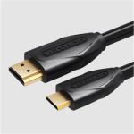 Vention VAA-D02-B150  Mini HDMI Cable 1.5M Black